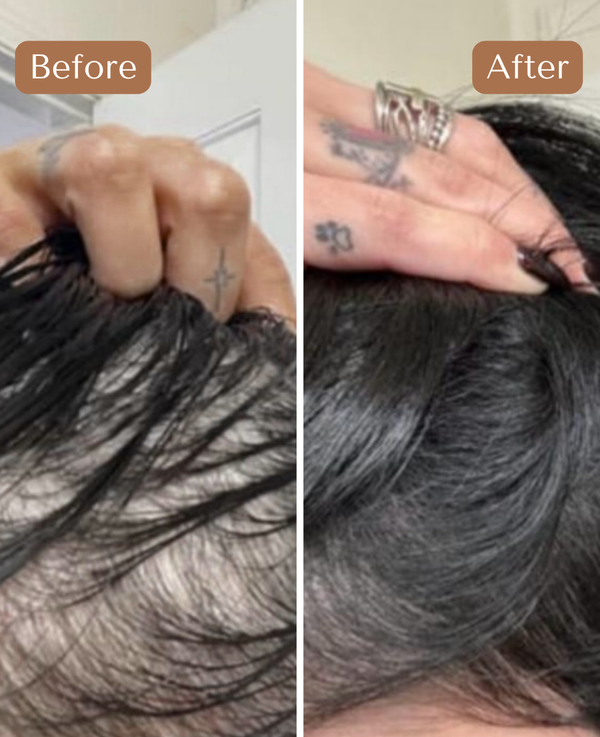 Custom Hair Growth Treatment