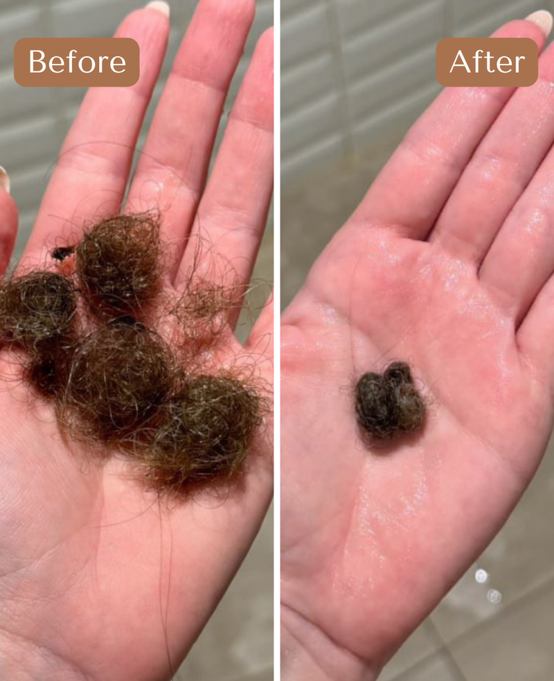 Custom Hair Growth Treatment