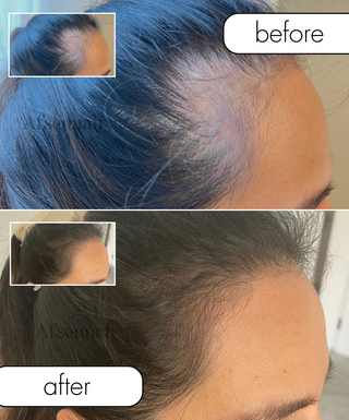 Hair Growth Oil