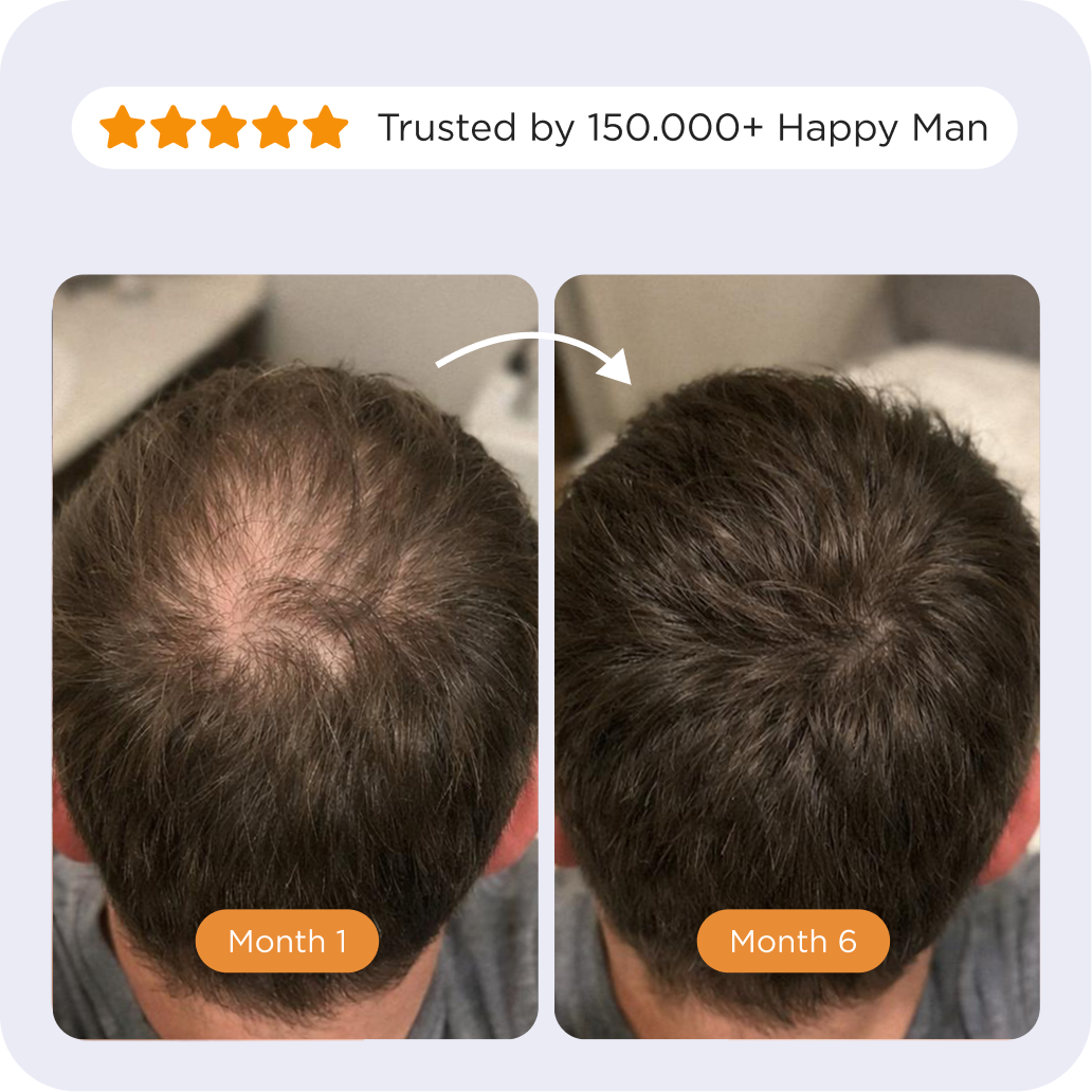 Custom Shampoo For Him