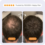 Custom Shampoo For Him