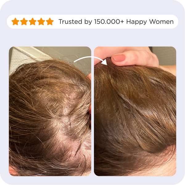 Before and after comparison photos of a customer using the Afsennah Custom Scalp Tonic