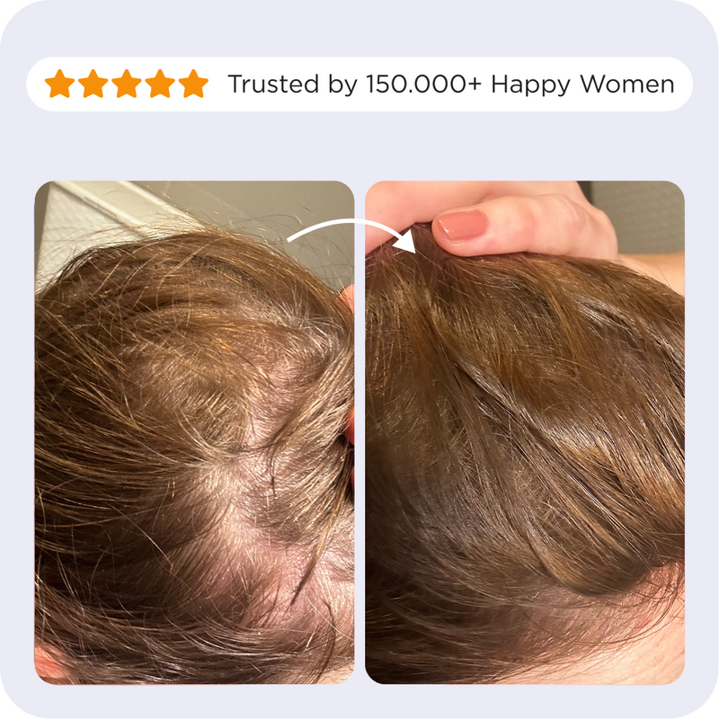 Before and after comparison photos of a customer using the Afsennah Custom Scalp Tonic