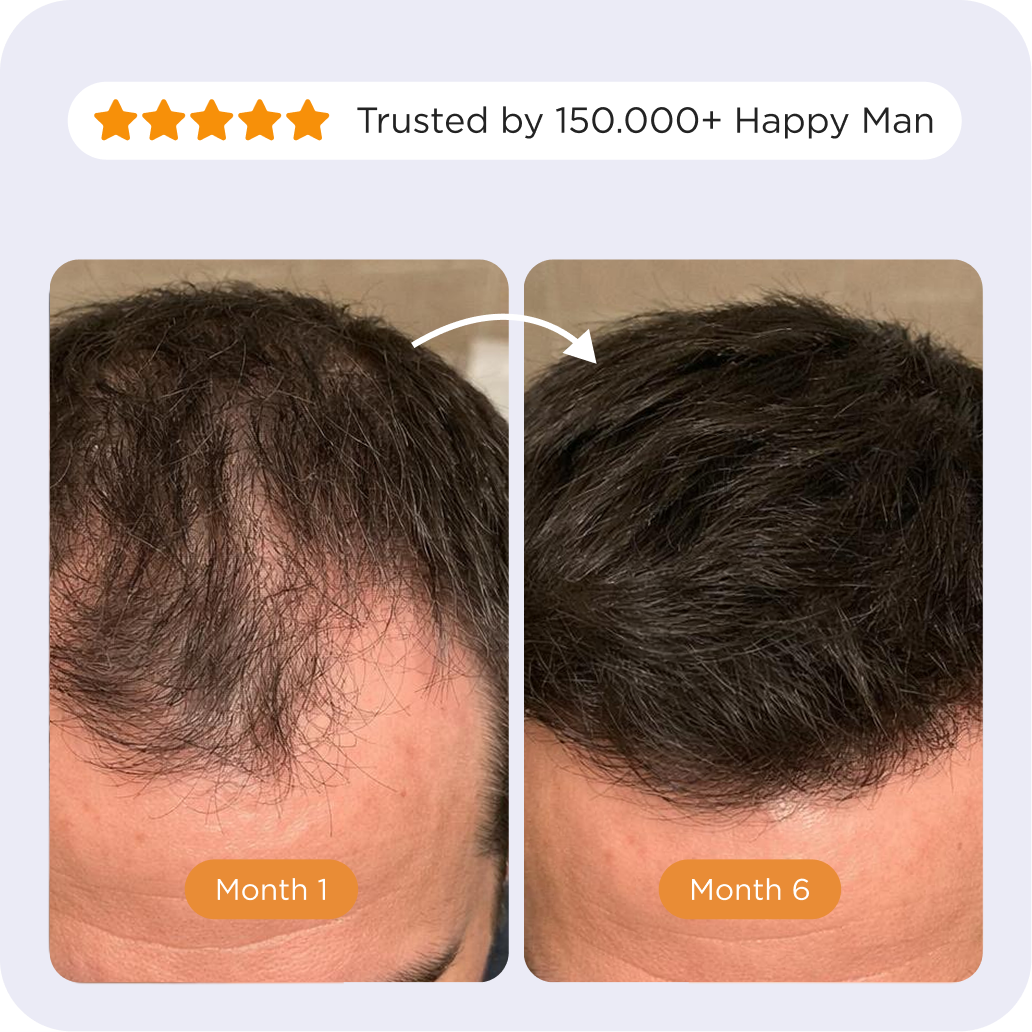 Custom Hair Growth Oil For Him