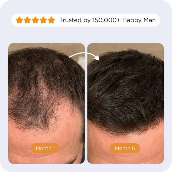 Comparison of the Afsennah Custom Hair Growth Oil for men against a generic brand