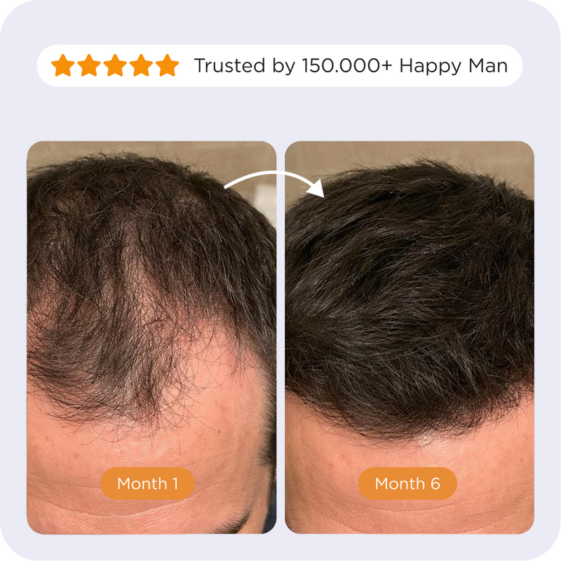 Comparison of the Afsennah Custom Hair Growth Oil for men against a generic brand