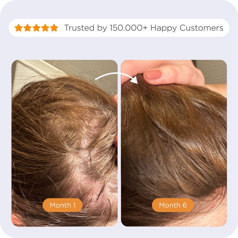 Comparison of the Afsennah Microneedle Scalp Roller against a generic scalp roller