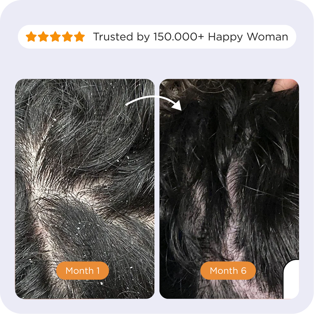 Custom Shampoo