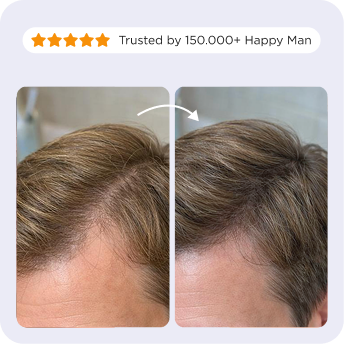 Afsennah Liquid Hair Growth Vitamins for men compared with tablet supplements