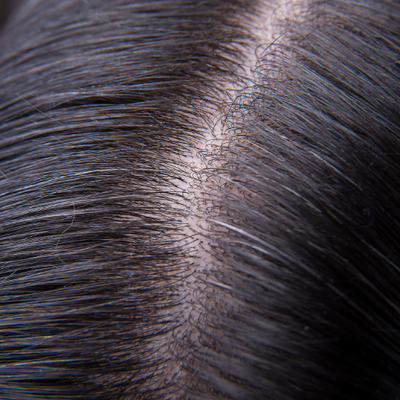 Medium (Scalp is somewhat visible)