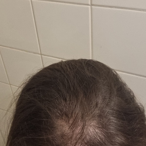 Photo by Eimante P.