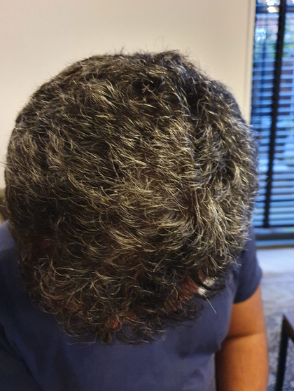 After