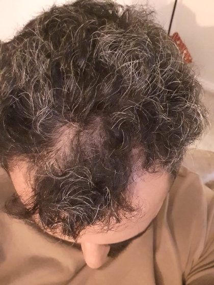 Before