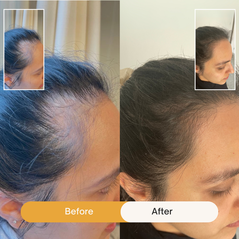 Before and after comparison photos of a customer using Afsennah hair products